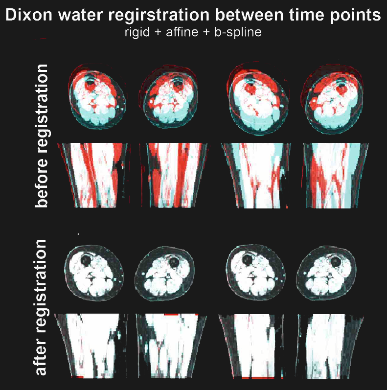 non rigid registration over time points